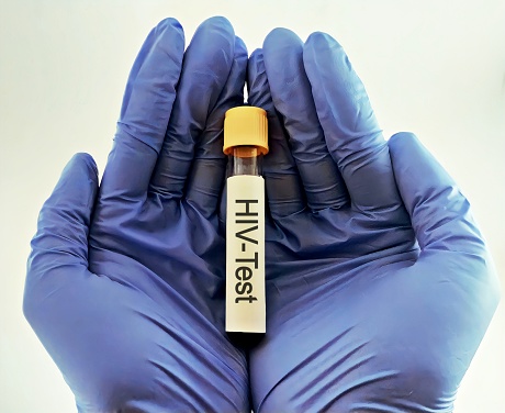 Sample blood collection tube with HIV test label in laboratory. Sample blood for screening test for HIV test in laboratory.