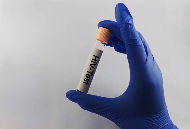 Sample blood for screening test for HIV test in laboratory.