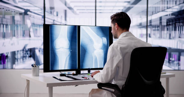 istock Doctor Screening Knee Bone X Ray 1954239590