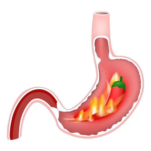Vector illustration of Cross section of stomach with hot flames and red chili pepper.