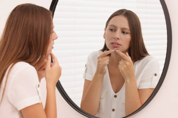 istock Woman with skin problem looking at mirror indoors 1954406433