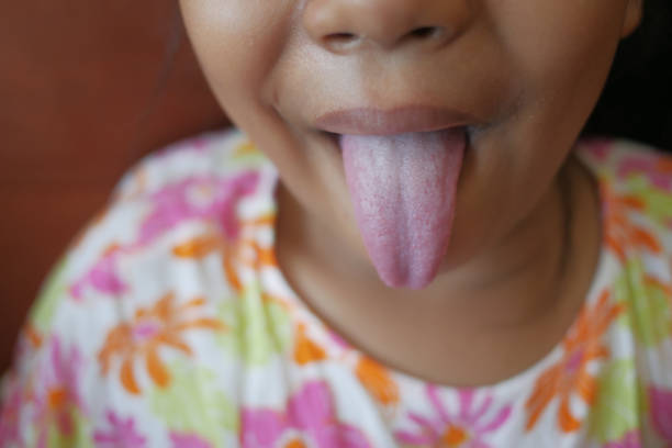 istock child shows his tongue closeup 1955489753