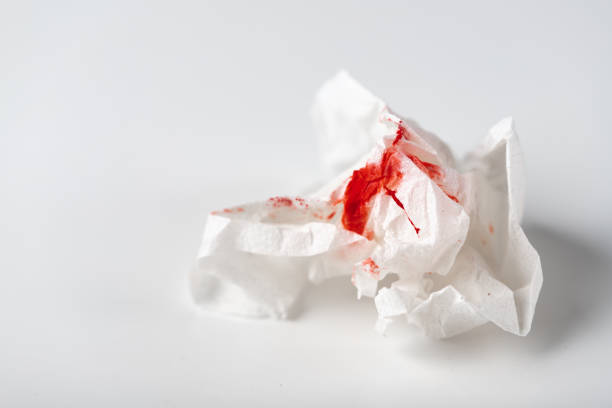 istock Fresh red blood stained on tissue paper on white table 1955614062
