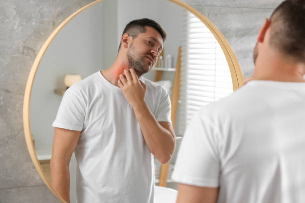 istock Man suffering from allergy looking at his neck in mirror indoors 1955823700