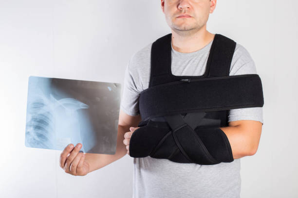 supporting the shoulder joint after surgery ripl fitness shoulder dislocation
