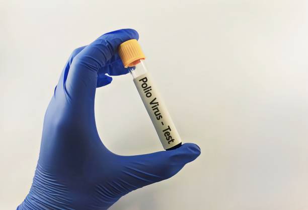 istock scientist or medical worker hand hold blood sample for Polio virus test 1960236508