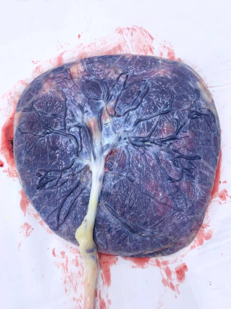生後すぐに胎盤。 - blood human vein animal vein human blood vessel ストックフォトと画像