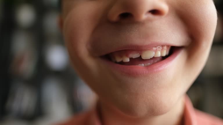 Close-up mouth child has lost one milk teeth. Replacement of permanent changing teeth, toothless smile and hole in the gum. Children is dentistry concept