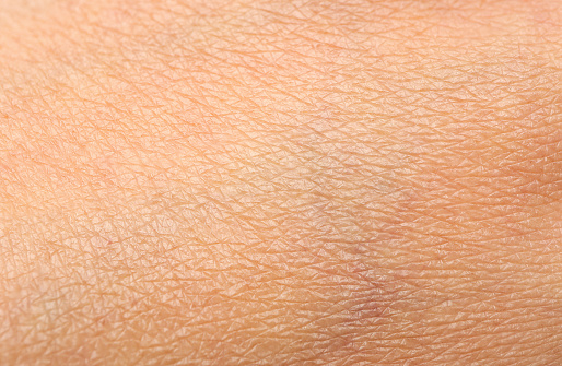 Dry human skin as background. Human skin texture.Macro