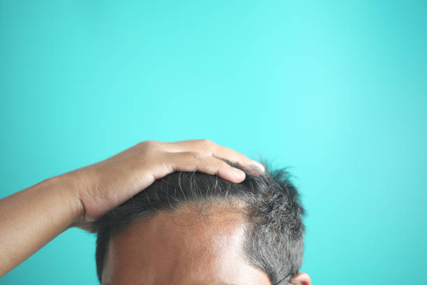 istock hair loss concept with man checking his hair 1961962392
