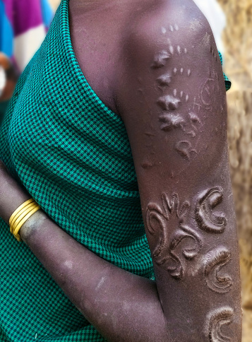 Omo Valley, Ethiopia - January 16, 2023 : Hand of a Mursi tibe woman with scarification. Both men and women of Mursi tribe are used to scarification, usually engraved on the upper body. It is called kitchoga or kitchoa and carried out with a simple but painful procedure using curved spines, and sharp blades.