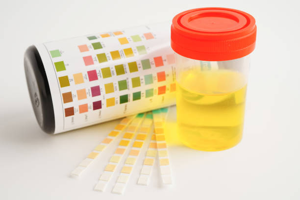istock Urinalysis, urine cup with reagent strip pH paper test and comparison chart in laboratory. 1964238804