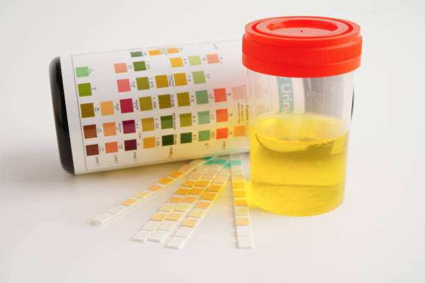 istock Urinalysis, urine cup with reagent strip pH paper test and comparison chart in laboratory. 1964240881