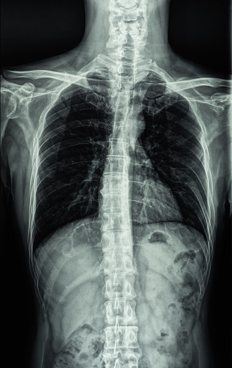 Human chest and spine X-ray images