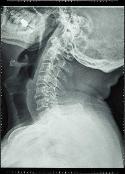 istock Human Head and Neck X-ray Film 1966707358