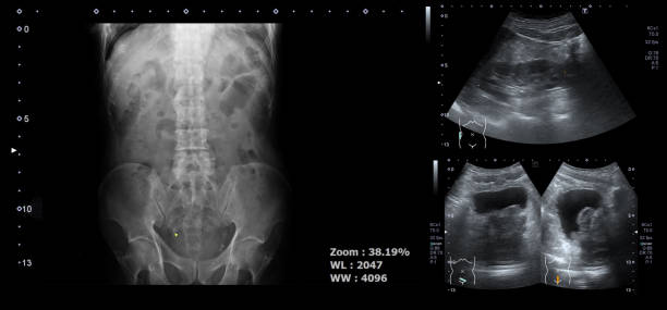 imágenes radiográficas de la columna vertebral o de la vejiga espinal y urinaria o de la vejiga para comprobar la próstata, la glándula o la próstata. - cat scan abdomen medical scan x ray fotografías e imágenes de stock