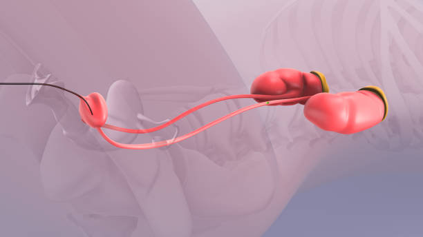 istock Ureteroscopy and laser lithotripsy for renal stones 1967570853