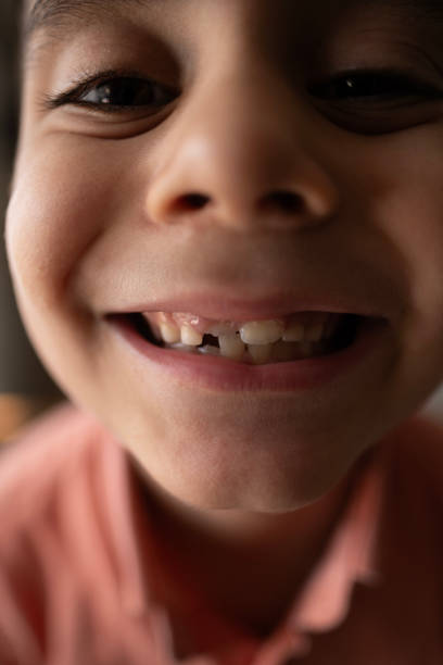 istock Close-up mouth child has lost one milk teeth. Replacement of permanent changing teeth, toothless smile and hole in the gum. Children's dentistry concept 1968101358