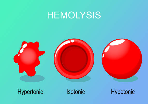 적혈구의 용혈. - blood cell anemia cell structure red blood cell stock illustrations