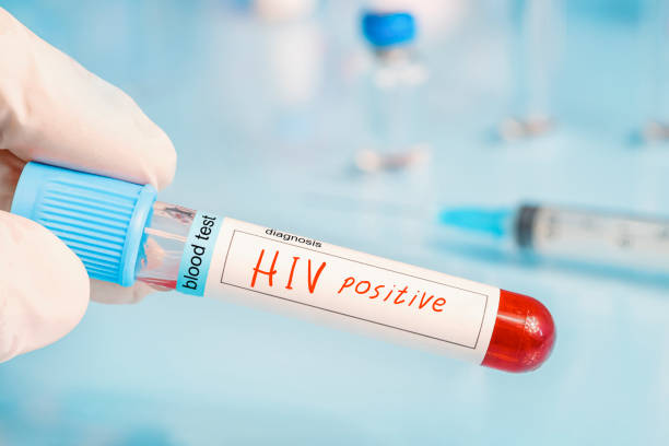 istock Diagnostician holding in hand a positive HIV test on blue laboratory background. 1976187798