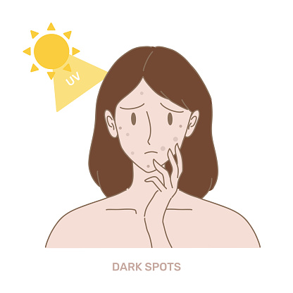 Woman with pigmented spots on face, Sun and UV rays behind. Hand drawn flat cartoon character vector illustration.