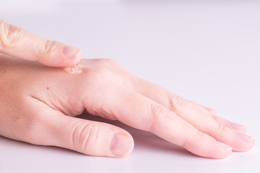 Woman applying gel or serum on hands, close-up. Hand Care concept