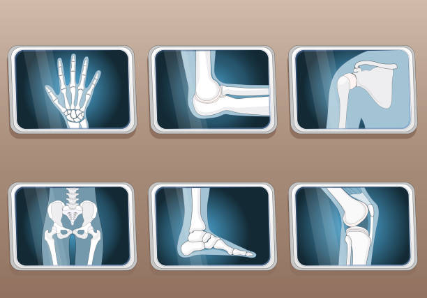 istock Knee, Elbow, wrist, hip, shoulder joints and Articulations of foot. Set icons. 1977137330