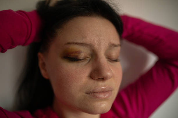 Young black haired woman with bruise on her eye
