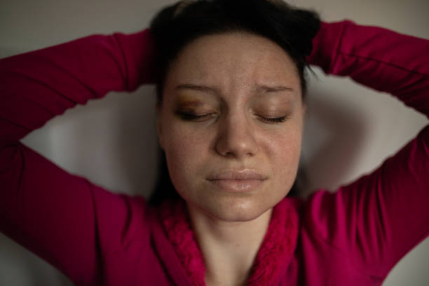 Sad woman hold head showing bruise on her eye