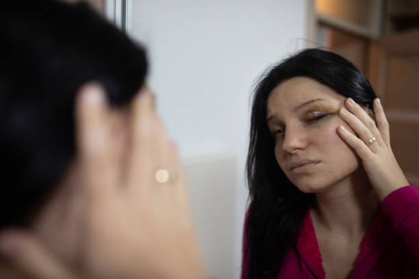 istock Woman with bruise on her eye looking herself in the mirror 1978305418