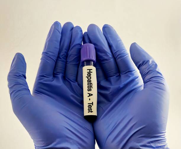 istock scientist or medical worker hand hold blood sample for Hepatitis A virus test 1979139301
