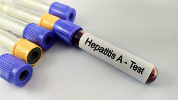 Hepatitis Test Solution Market Strategies: Competitive Insights for Expansion Hepatitis Test Solution Market Strategies: Competitive Insights for Expansion