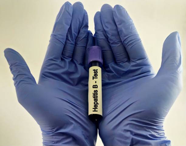 istock scientist or medical worker hand hold blood sample for Hepatitis B virus test 1979147048