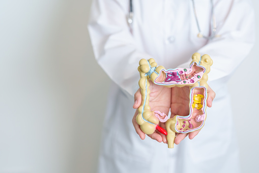 Doctor holding human Colon anatomy model. Colonic disease, Large Intestine, Colorectal cancer, Ulcerative colitis, Diverticulitis, Irritable bowel syndrome, Digestive system and Health concept