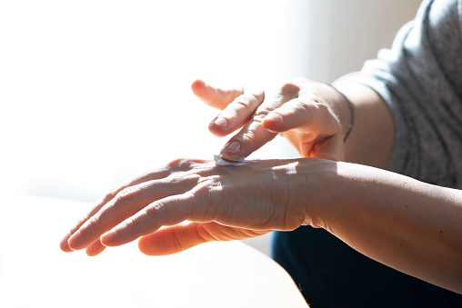 Woman applying moisturizer cream on dry hands