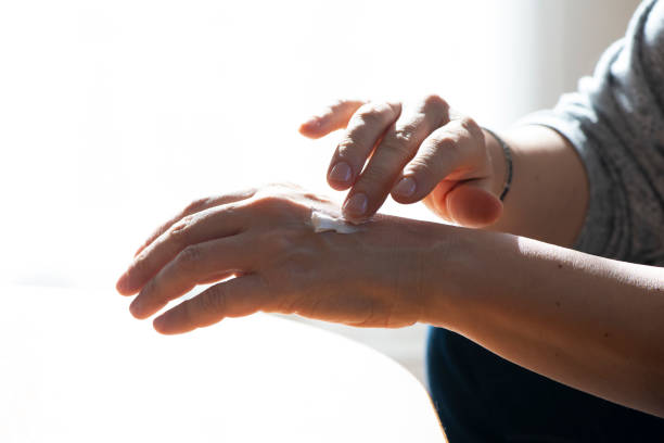 istock Woman applying moisturizer cream on dry hands 1979910371