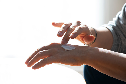 Woman applying moisturizer cream on dry hands