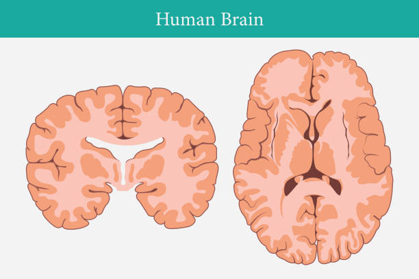 ilustraciones, imágenes clip art, dibujos animados e iconos de stock de untitled-1 - mri scan brain alzheimers disease medical scan