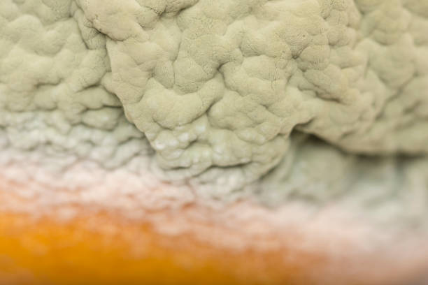 Rhizopus (bread mold) is a genus of common saprophytic fungi,Rhizopus (bread mold)  under the microscope.