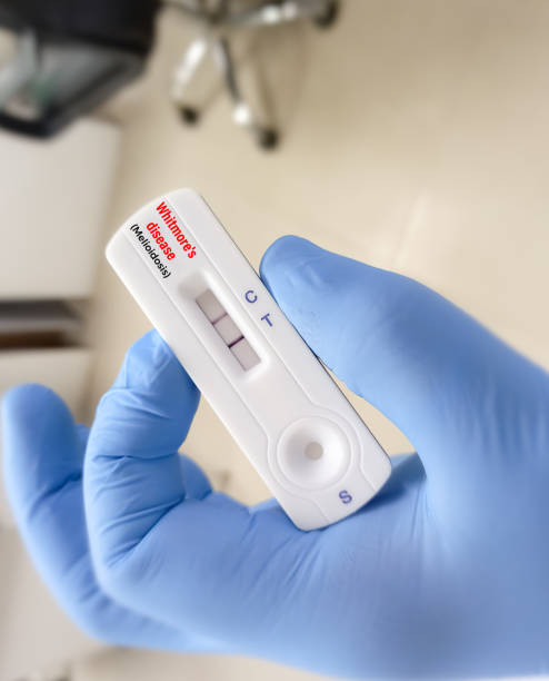 istock Rapid test cassette for Melioidosis test, also called Whitmore's disease cauaed by gram negative bacterium called Burkholderia pseudomallei. 1984435985
