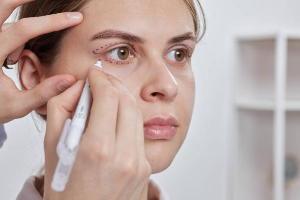 istock plastic surgeon prepares for Blepharoplasty, Blepharoplasty operation 1986031946