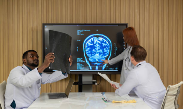 multicultural medical team discussing patients mri film in hospital setting - neuroscience mri scan brain brain surgery - fotografias e filmes do acervo