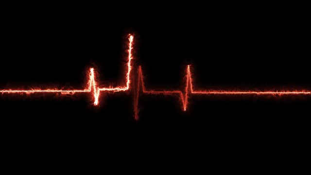 Heartbeat Monitor Animated Video, Heartbeat Medical Cardiogram Animation