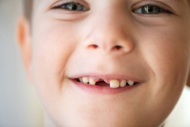 istock Cute little boy smiling with a milky tooth gap 1989845182