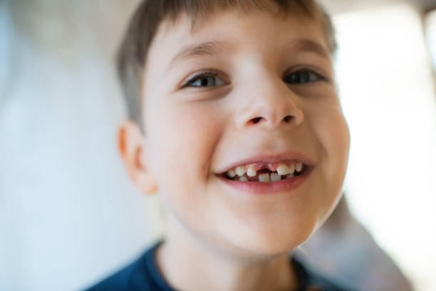 istock Cute little boy smiling with a milky tooth gap 1989845437