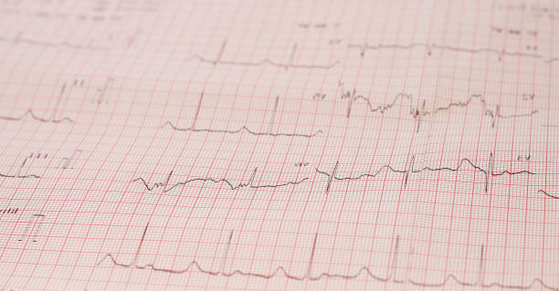 istock heart rate paper sheet 1992517988