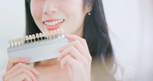 istock female use teeth color comparasion 1992717496
