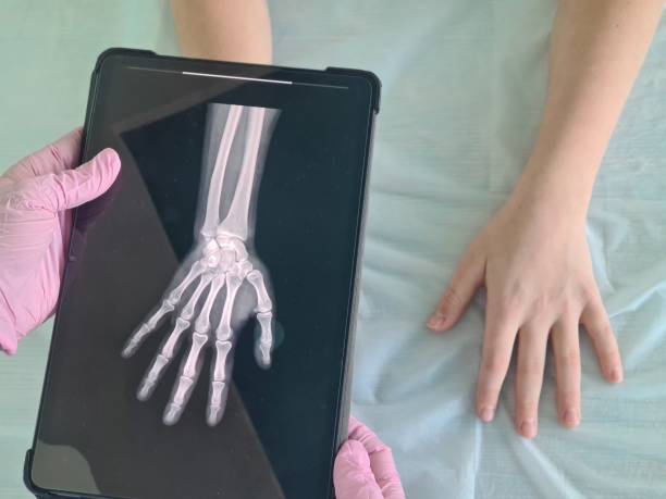 istock A doctor holding a hand x-ray on a tablet with a patients hand next to it. 1992867964