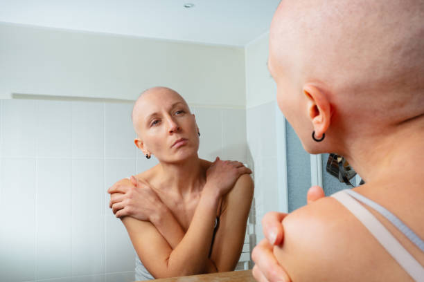 istock Young woman confronting in mirror self-image with baldness 1993372170