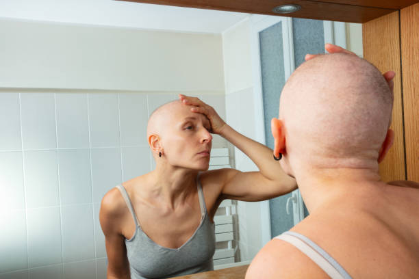 istock Bald young woman after chemotherapy assess herself in mirror 1993372683